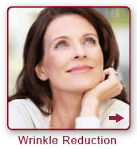 wrinkle reducing injections botox